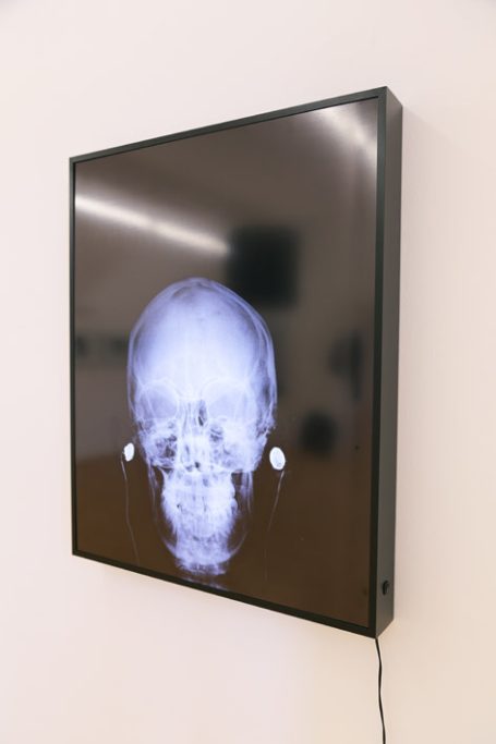 Röntgenbild eines Schädels, frontal ansicht. Dunkler Hintergrund, beleuchtet.